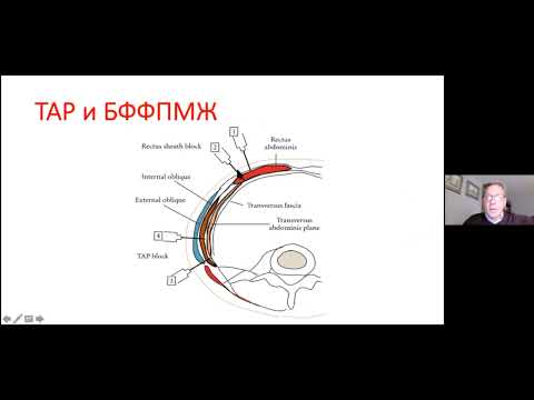 Видео: Блокада фасциального футляра прямой мышцы живота