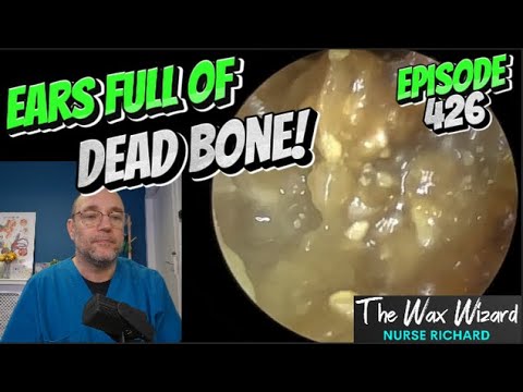 Видео: УШИ ПОЛНЫ МЕРТВЫХ КОСТЕЙ! Эпизод 426