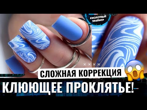 Видео: ⚡РАЗРОСШИЙСЯ ГИПОНИХИЙ!😱 СНОВА ГРИФОЗНЫЕ НОГТИ!🔥Коррекция клюющих ногтей гелем👌