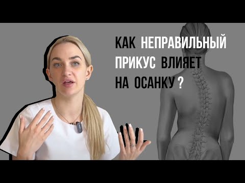 Видео: Неправильный прикус влияет на осанку❓