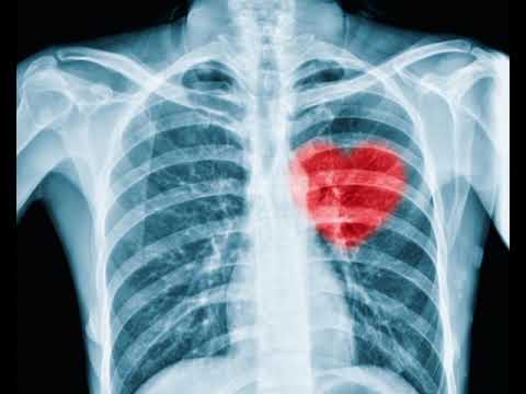 Видео: Близнецовые пламена. Больше не влюбляюсь (гормоны отмена)