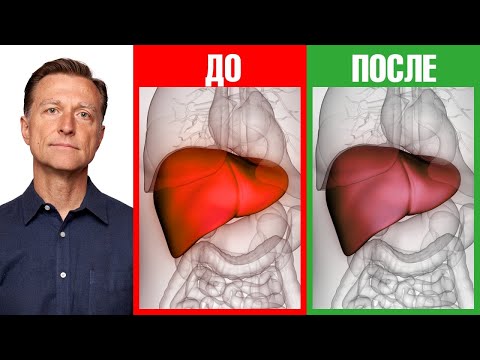 Видео: Лечение гепатита С за 90 000 долларов😨 VS альтернативы