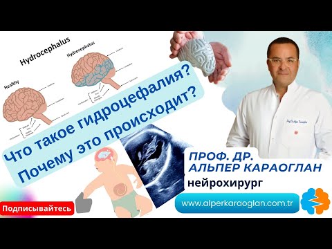 Видео: Что такое гидроцефалия? Почему это происходит? | Проф. Др. Альпер КАРАОГЛАН