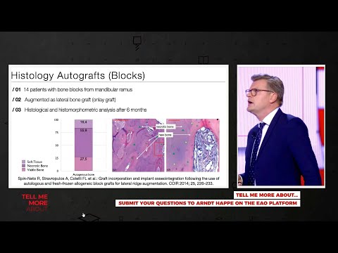 Видео: Латеральная аугментация: аутогенная кость или аллотрансплантат? Арнд Хаппе