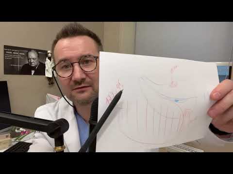 Видео: Обзор пациентов от 02 июня 2023 года