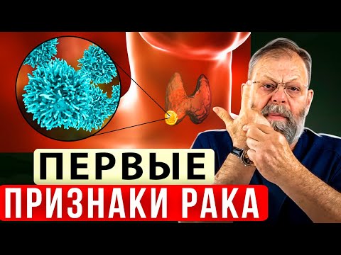 Видео: Как выявить онкологию у человека? Доктор медицинских наук.