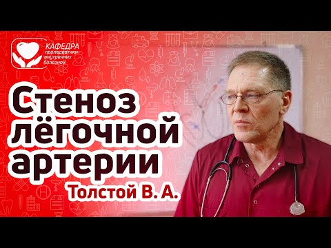 Видео: ВПС. Стеноз лёгочной артерии.