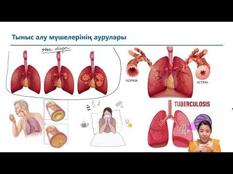 Видео: ТЫНЫС АЛУ МҮШЕЛЕРІНІҢ АУРУЛАРЫ || ХИМИЯ - БИОЛОГИЯ МЕКТЕБІ || НЕСІБЕЛІ АПАЙ