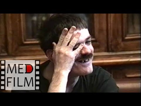 Видео: Олигофрения в степени имбецильности. Задержка психического развития © Oligophrenia, imbecility