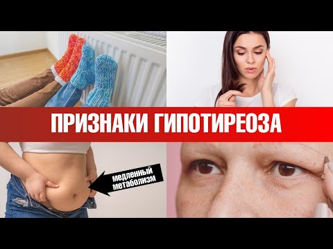Видео: Ранние симптомы гипотиреоза. Диагностика гипотиреоза✅