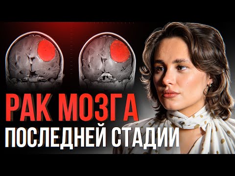 Видео: ⚠️ Я почти победила РАК мозга: откровения ДЕВУШКИ, которая выжила после диагноза