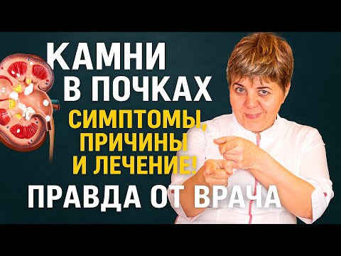 Видео: 💥 Камни в Почках: Симптомы, Причины и Лечение! Правда от Врача