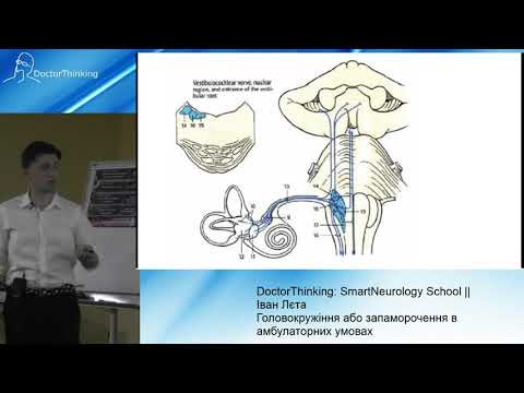Видео: Головокружіння або запаморочення в амбулаторних умовах