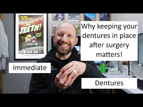 Видео: Почему важно сохранять зубные протезы на месте после удаления зубов
