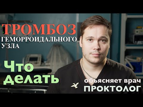 Видео: ТРОМБОЗ ГЕМОРРОИДАЛЬНОГО УЗЛА - Что делать, как лечить - объясняет врач Проктолог.
