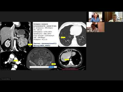 Видео: Лекарственная терапия в онкоурологии (вебинар 6 октября 2021)