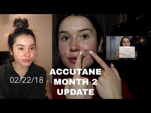 Видео: МОЙ ПУТЕШЕСТВИЕ С АККУТЕЙНОМ: обновление за 2-й месяц