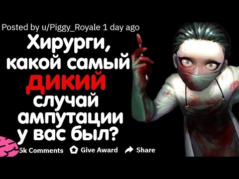 Видео: ХИРУРГИ, КАКОЙ САМЫЙ ДИКИЙ СЛУЧАЙ АМПУТАЦИИ У ВАС БЫЛ?