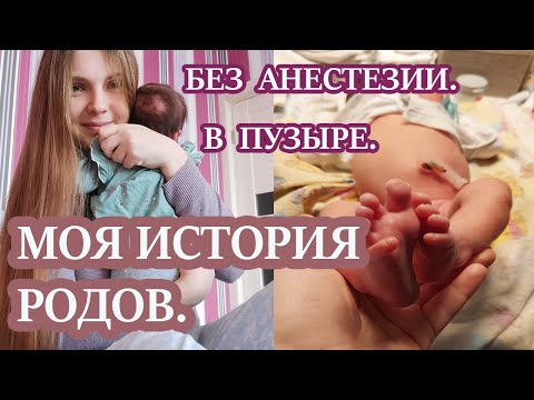 Видео: 🤰МОЯ ИСТОРИЯ РОДОВ. РОДЫ БЕЗ АНЕСТЕЗИИ. ВТОРЫЕ РОДЫ.