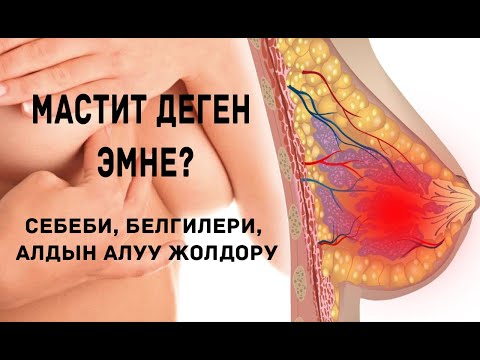 Видео: Мастит деген эмне? Себеби, белгилери, алдын алуу жолдору