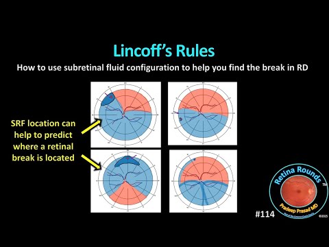Видео: RetinaRounds™ 114: Правила Линкоффа