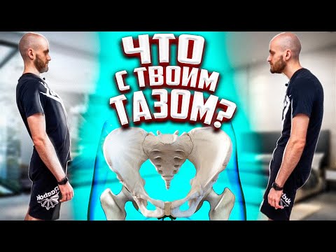 Видео: Про таз и позвоночник! Почему болит спина? От чего зависит осанка? Здоровая спина