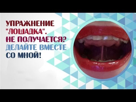 Видео: Артикуляционная гимнастика. Как научить ребёнка упражнению "Лошадка"?