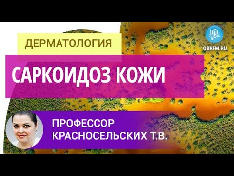 Видео: Профессор Красносельских Т.В.: Саркоидоз кожи