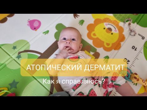 Видео: Атопический дерматит у ребенка. Как я справляюсь?