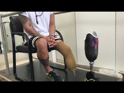 Видео: The first steps on the prosthesis. Первые шаги на протезе. Кима Дима. Ощущения. Радость.