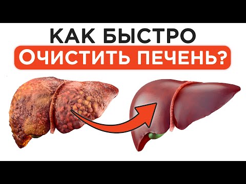Видео: Как ИЗБАВИТЬСЯ от ПРОБЛЕМ с печенью? / Учимся заботиться о здоровье нашей печени