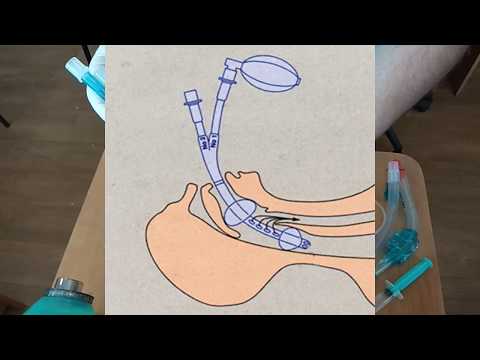 Видео: КОМБИТЬЮБ (COMBITUBE) ТРАХЕО-ПИЩЕВОДНАЯ ТРУБКА  АБАКАН  ТЕХНИКА УСТАНОВКИ ВВЕДЕНИЯ