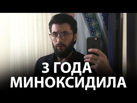 Видео: 3 ГОДА НА МИНОКСИДИЛЕ | РЕЗУЛЬТАТЫ