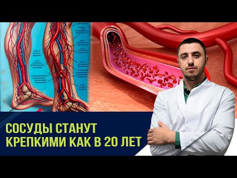 Видео: Мерзнут ноги и руки. Как укрепить сосуды и согреть тело