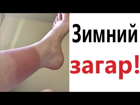 Видео: Лютые приколы. ЗИМНИЙ ЗАГАР!!! Попробуй не засмеяться! САМОЕ смешное видео! - Domi Show!