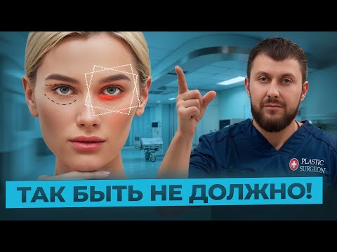 Видео: БЛЕФАРОПЛАСТИКА Осложнения: Что делать? Разбор от хирурга на ПРИМЕРЕ