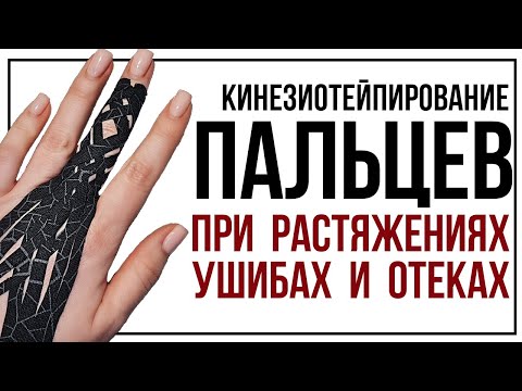 Видео: Кинезиотейпирование пальца при растяжениях, ушибах и гематомах.