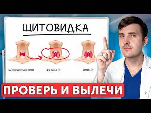 Видео: Как САМОСТОЯТЕЛЬНО проверить щитовидку? Лучшая профилактика и лечение в 2025