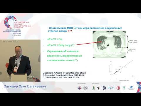 Видео: Протективная ИВЛ на спонт дых Сатишур О.Е.