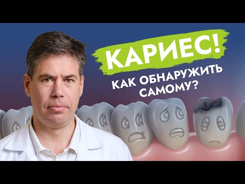 Видео: Как самому обнаружить кариес? Информация для любознательных!