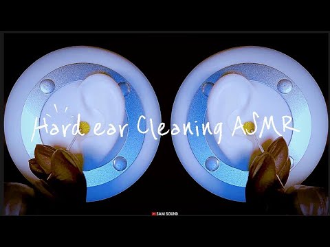 Видео: ASMR Рекомендуется звук ушной серы !! 👍 Жесткая чистка ушей с помощью 4 инструментов (No talking)
