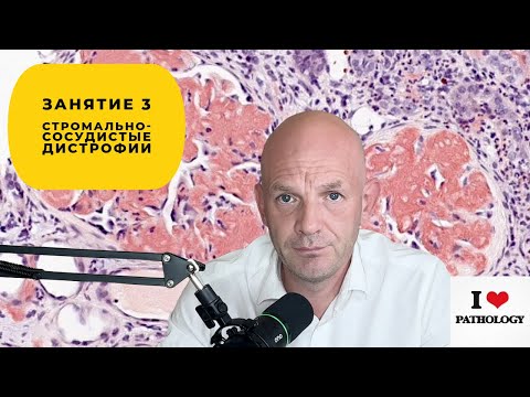 Видео: Стромально-сосудистые (внеклеточные) дистрофии - краткий обзор занятия №3