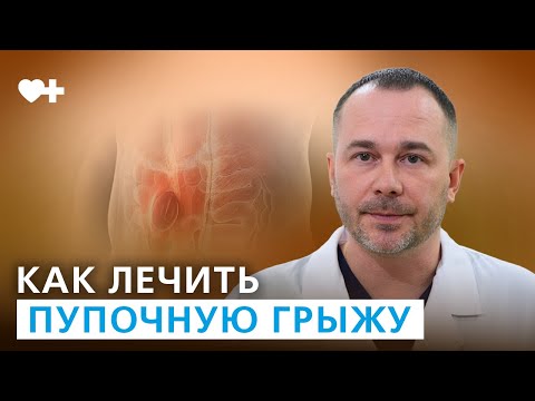 Видео: Пупочная грыжа у взрослых: причины возникновения и методы лечения.