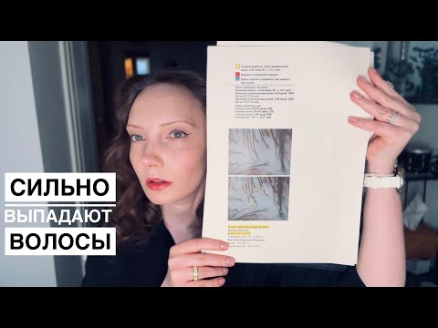 Видео: Телогеновое выпадение волос. Андрогенетическая алопеция. Моя история и лечение