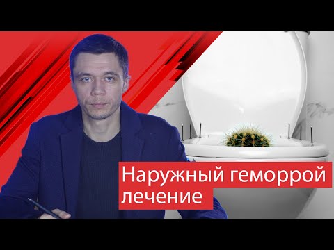 Видео: Наружный геморрой - подробное видео о лечении