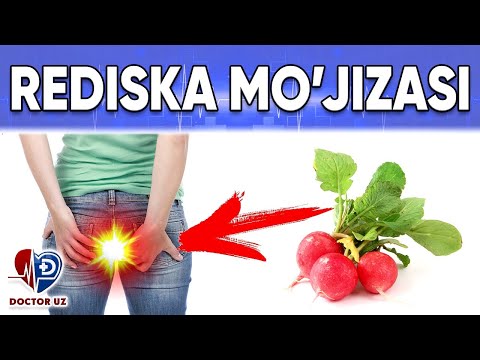 Видео: ДИҚҚАТ! РЕДИСКАНИ СИЗ БИЛМАГАН СИРЛАРИ ОЧИЛДИ ТЕЗ КЎРИНГ.