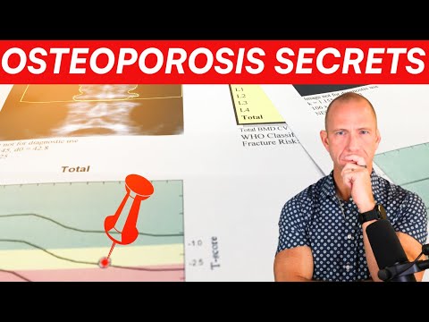 Видео: Что они не хотят, чтобы вы знали об остеопорозе!