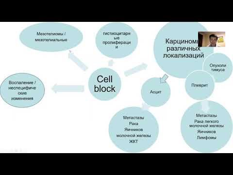 Видео: Технология cell-block в исследовании выпотных жидкостей