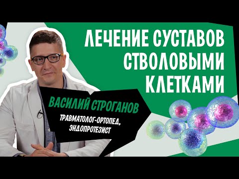 Видео: Лечение суставов стволовыми клетками | Stromal Vascular или стромально васкулярная SVF-терапия