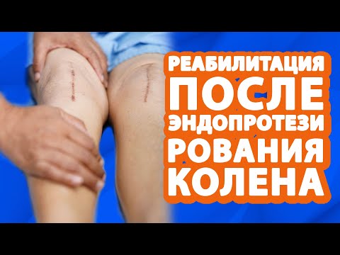 Видео: Коленный сустав // Реабилитация после эндопротезирования коленного сустава #клиниказдравствуй